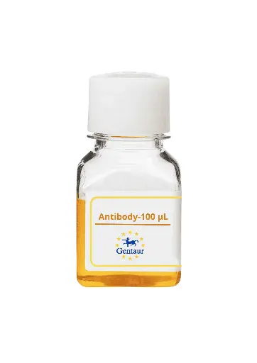 [CSB-1035] ALKBH3 Antibody  FITC conjugated   
